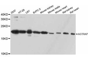 Western blot analysis of extracts of various cell lines, using AGTRAP antibody.