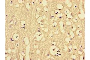 Immunohistochemistry of paraffin-embedded human brain tissue using ABIN7149360 at dilution of 1:100 (CKAP2L Antikörper  (AA 246-413))