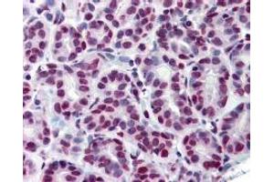 Immunohistochemistry (IHC) image for anti-Signal Transducer and Activator of Transcription 5A (STAT5A) (Tyr694) antibody (ABIN400812) (STAT5A Antikörper  (Tyr694))