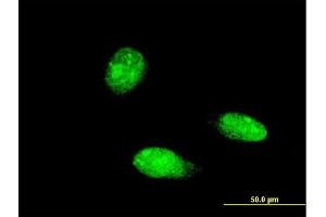 Immunofluorescence of monoclonal antibody to TRIM46 on HeLa cell. (TRIM46 Antikörper  (AA 451-560))