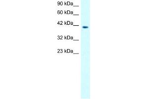 MMP19 antibody used at 0. (MMP19 Antikörper  (N-Term))