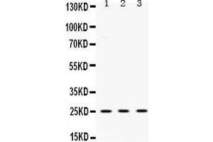 Western Blotting (WB) image for anti-Ubiquitin Carboxyl-terminal Esterase L1 (Ubiquitin Thiolesterase) (UCHL1) (AA 120-153), (C-Term) antibody (ABIN3042339)