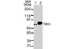 TBK1 NAK Western Blot. (TBK1 Antikörper)