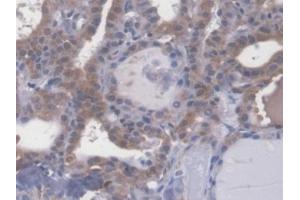 #VALUE! (Esophageal Cancer Related Gene 4 (AA 32-148) Antikörper)