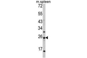 Western blot analysis of FKBP11 Antibody (C-term) in mouse spleen tissue lysates (35ug/lane).