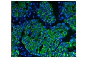 IF analysis of Cytokeratin 8 using anti-Cytokeratin 8 antibody (ABIN6719478). (KRT8 Antikörper  (AA 107-325))