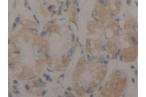 Immunohistochemistry (IHC) image for anti-Keratin 17 (KRT17) (AA 252-393) antibody (ABIN7434125)