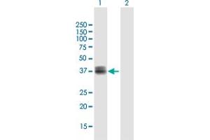 Western Blot analysis of WISP3 expression in transfected 293T cell line by WISP3 MaxPab polyclonal antibody.