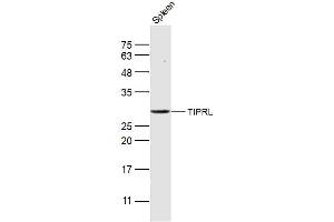 Mouse spleen lysates probed with TIPRL Polyclonal Antibody, Unconjugated  at 1:300 dilution and 4˚C overnight incubation. (TIPRL Antikörper  (AA 51-150))