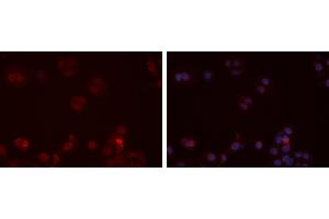 ABIN6273472 staining Hela cells by IF/ICC. (CX3CR1 Antikörper  (N-Term))