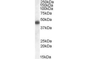 Western Blotting (WB) image for anti-Apolipoprotein L, 1 (APOL1) (C-Term) antibody (ABIN2466595) (APOL1 Antikörper  (C-Term))
