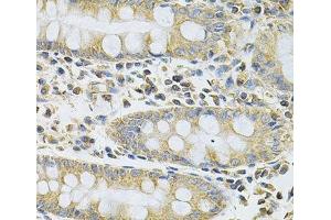 Immunohistochemistry (Paraffin-embedded Sections) (IHC (p)) image for anti-serpin Peptidase Inhibitor, Clade A (Alpha-1 Antiproteinase, Antitrypsin), Member 6 (SERPINA6) antibody (ABIN7008381)