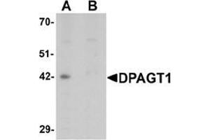 Western blot analysis of DPAGT1 in mouse kidney tissue lysate with DPAGT1 antibody at 1 μg/mL in (A) the absence and (B) the presence of blocking peptide. (DPAGT1 Antikörper  (N-Term))