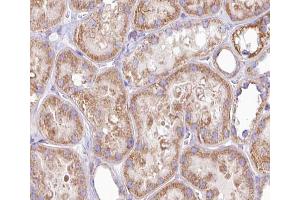 ABIN6266902 at 1/100 staining human kidney tissue sections by IHC-P. (DGKH Antikörper  (Internal Region))