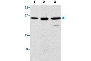 Western blot analysis of human (1), mouse (2), and rat (3) kidney cells with TICAM2 polyclonal antibody  at 1 ug/mL dilution. (TICAM2 Antikörper  (C-Term))
