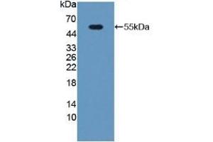 Detection of Recombinant PGP, Mouse using Polyclonal Antibody to Phosphoglycolate Phosphatase (PGP) (PGP Antikörper  (AA 81-321))