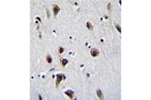 Formalin fixed, paraffin embedded human brain tissue stained with MeCP2 Antibody (N-term) followed by peroxidase conjugation of the secondary antibody and DAB staining. (MECP2 Antikörper  (N-Term))