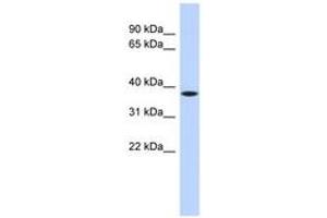 Image no. 1 for anti-Chromosome 22 Open Reading Frame 30 (C22orf30) (AA 1979-2028) antibody (ABIN6743853) (C22ORF30 Antikörper  (AA 1979-2028))