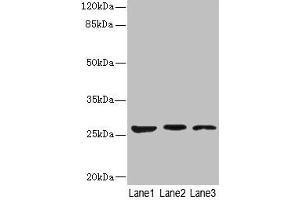 Western blot All lanes: KLK6 antibody at 5 μg/mL Lane 1: Mouse liver tissue Lane 2: Mouse brain tissue Lane 3: A375 whole cell lysate Secondary Goat polyclonal to rabbit IgG at 1/10000 dilution Predicted band size: 27, 16, 5 kDa Observed band size: 27 kDa (Kallikrein 6 Antikörper  (AA 22-244))