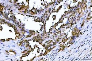 IHC analysis of TIF1 gamma using anti-TIF1 gamma antibody (ABIN3043492). (TRIM33 Antikörper  (AA 1001-1127))