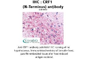 Image no. 2 for anti-Corticotropin Releasing Hormone Receptor 1 (CRHR1) (Extracellular Domain), (N-Term) antibody (ABIN1733304) (CRHR1 Antikörper  (Extracellular Domain, N-Term))