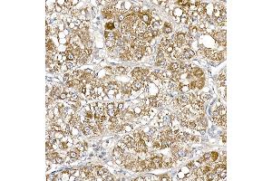 Immunohistochemistry of paraffin-embedded human liver cancer using S Rabbit mAb (ABIN7270501) at dilution of 1:250 (40x lens).