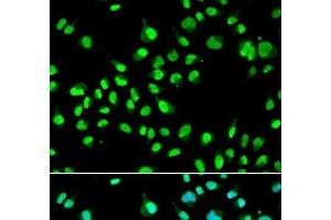 Immunofluorescence analysis of A549 cells using GTF2F2 Polyclonal Antibody