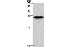 Western blot analysis of Mouse skeletal muscle tissue, using TNFRSF17 Polyclonal Antibody at dilution of 1:200 (BCMA Antikörper)