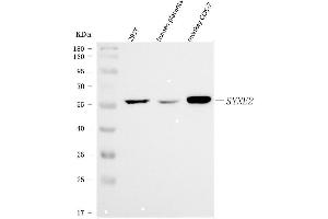 Western blot analysis of Nesprin 2/SYNE2 using anti-Nesprin 2/SYNE2 antibody (ABIN7601532). (SYNE2 Antikörper  (AA 3765-5590))