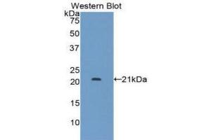 Western Blotting (WB) image for anti-Leukemia Inhibitory Factor Receptor alpha (LIFR) (AA 522-691) antibody (ABIN3208381) (LIFR Antikörper  (AA 522-691))