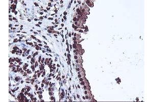 Immunohistochemical staining of paraffin-embedded Human breast tissue using anti-OSGEP mouse monoclonal antibody. (OSGEP Antikörper  (AA 1-335))