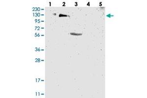Western blot analysis of Lane 1: RT-4, Lane 2: U-251 MG, Lane 3: Human Plasma, Lane 4: Liver, Lane 5: Tonsil with USP36 polyclonal antibody  at 1:250-1:500 dilution. (USP36 Antikörper)