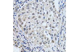 Immunohistochemistry (Paraffin-embedded Sections) (IHC (p)) image for anti-LSM4 Homolog, U6 Small Nuclear RNA Associated (LSM4) (AA 1-139) antibody (ABIN6143363)