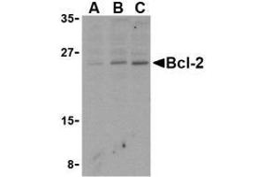 Western blot analysis of Bcl-2 in Daudi cell lysates with AP30128PU-N Bcl-2 antibody at (A) 1, (B) 2, and (C) 4 μg/ml. (Bcl-2 Antikörper  (N-Term))