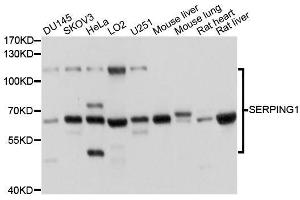 Western Blotting (WB) image for anti-Serpin Peptidase Inhibitor, Clade G (C1 Inhibitor), Member 1 (SERPING1) (AA 201-500) antibody (ABIN3022430)