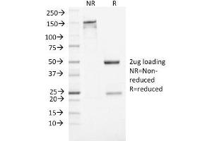 SDS-PAGE Analysis Purified NSE gamma Mouse Monoclonal Antibody (ENO2/1462).