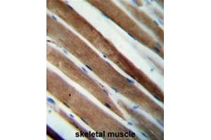 CCDC38 Antibody (Center) immunohistochemistry analysis in formalin fixed and paraffin embedded human skeletal muscle followed by peroxidase conjugation of the secondary antibody and DAB staining. (CCDC38 Antikörper  (Middle Region))