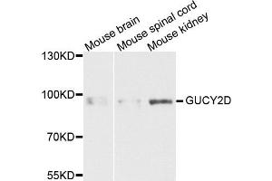 Western blot analysis of extracts of various cells, using GUCY2D antibody. (GUCY2D Antikörper)