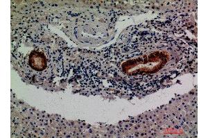 Immunohistochemical analysis of paraffin-embedded human-liver, antibody was diluted at 1:200 (F13B Antikörper  (Internal Region))