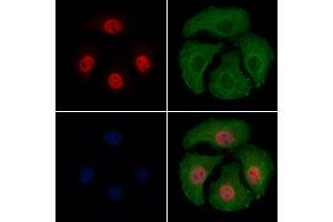ABIN6256594 and ABIN6267389 staining Hela cells(4h of LPS treatment) by IF/ICC.