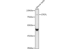 Western blot analysis of extracts of various cell lines, using CTCFL antibody (ABIN6131039, ABIN6139183, ABIN6139185 and ABIN6221755) at 1:1000 dilution. (CTCFL Antikörper  (AA 1-270))