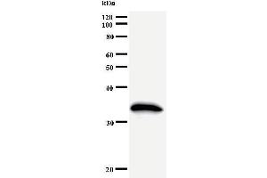 Western Blotting (WB) image for anti-General Transcription Factor IIH, Polypeptide 2, 44kDa (GTF2H2) antibody (ABIN930961)