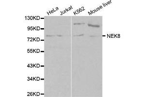 Western Blotting (WB) image for anti-NIMA-Related Kinase 8 (NEK8) (AA 1-300) antibody (ABIN3021226)