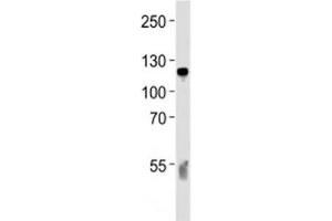 Western blot analysis of lysate from human blood plasma tissue lysate using C6 antibody diluted at 1:1000 for each lane. (C6 Antikörper  (AA 30-58))