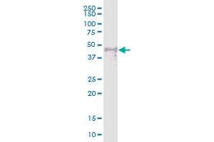 Western Blotting (WB) image for anti-Wilms Tumor 1 Interacting Protein (WTIP) (AA 1-430) antibody (ABIN1327433)