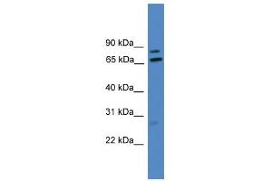 WB Suggested Anti-LRRFIP1 Antibody Titration: 0. (LRRFIP1 Antikörper  (Middle Region))