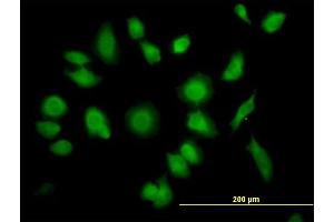 Immunofluorescence of purified MaxPab antibody to TTC1 on HeLa cell. (TTC1 Antikörper  (AA 1-292))
