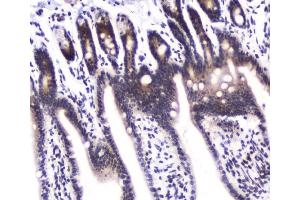 IHC analysis of DGCR8 using anti-DGCR8 antibody (ABIN5692841). (DGCR8 Antikörper  (AA 561-762))