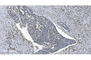 IHC analysis of SAMHD1 using anti-SAMHD1 antibody (ABIN7601514). (SAMHD1 Antikörper  (AA 37-626))