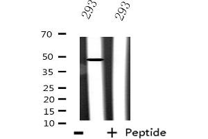 Western blot analysis of extracts from 293 cells using CSTF1 antibody. (CSTF1 Antikörper  (N-Term))